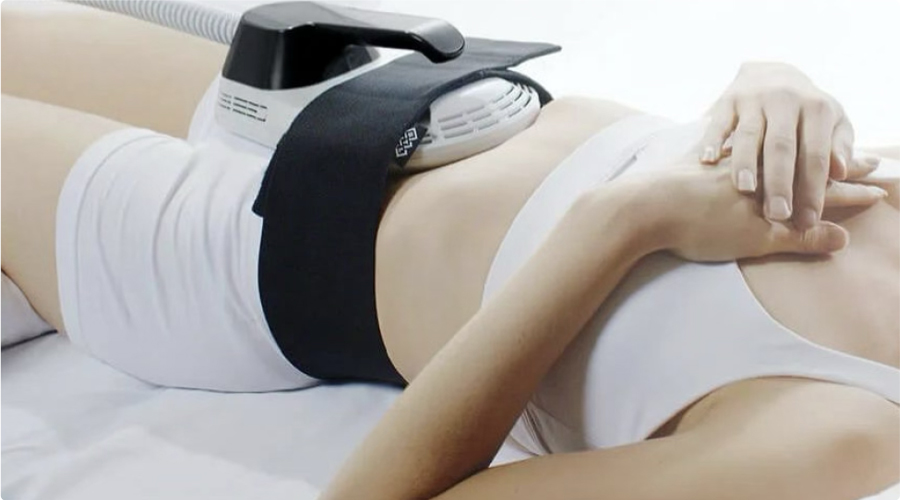 EMSLIM(高密度電磁場刺激)