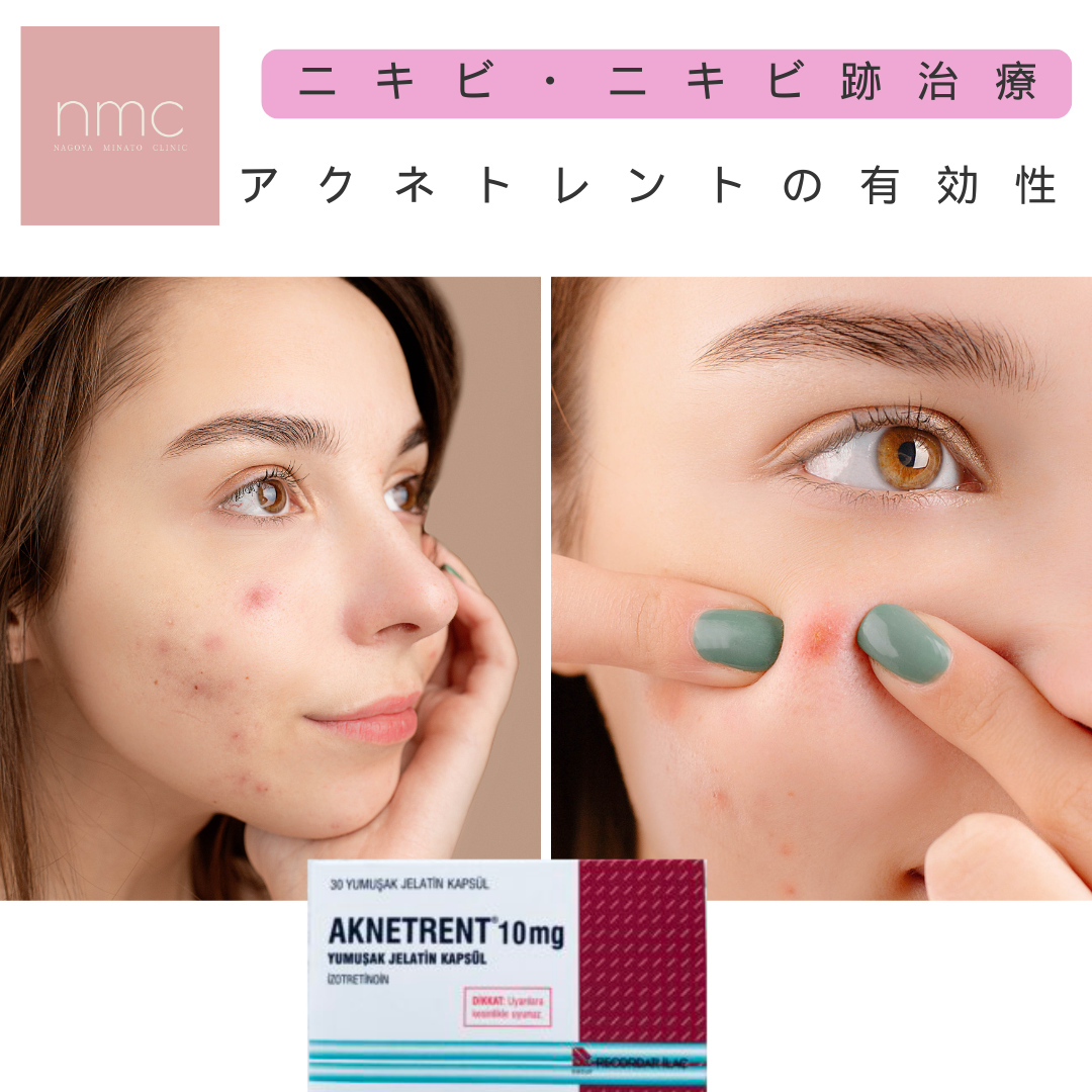 ニキビ・ニキビ跡の治療に対して、アクネトレントはどのような効果を発揮するか？