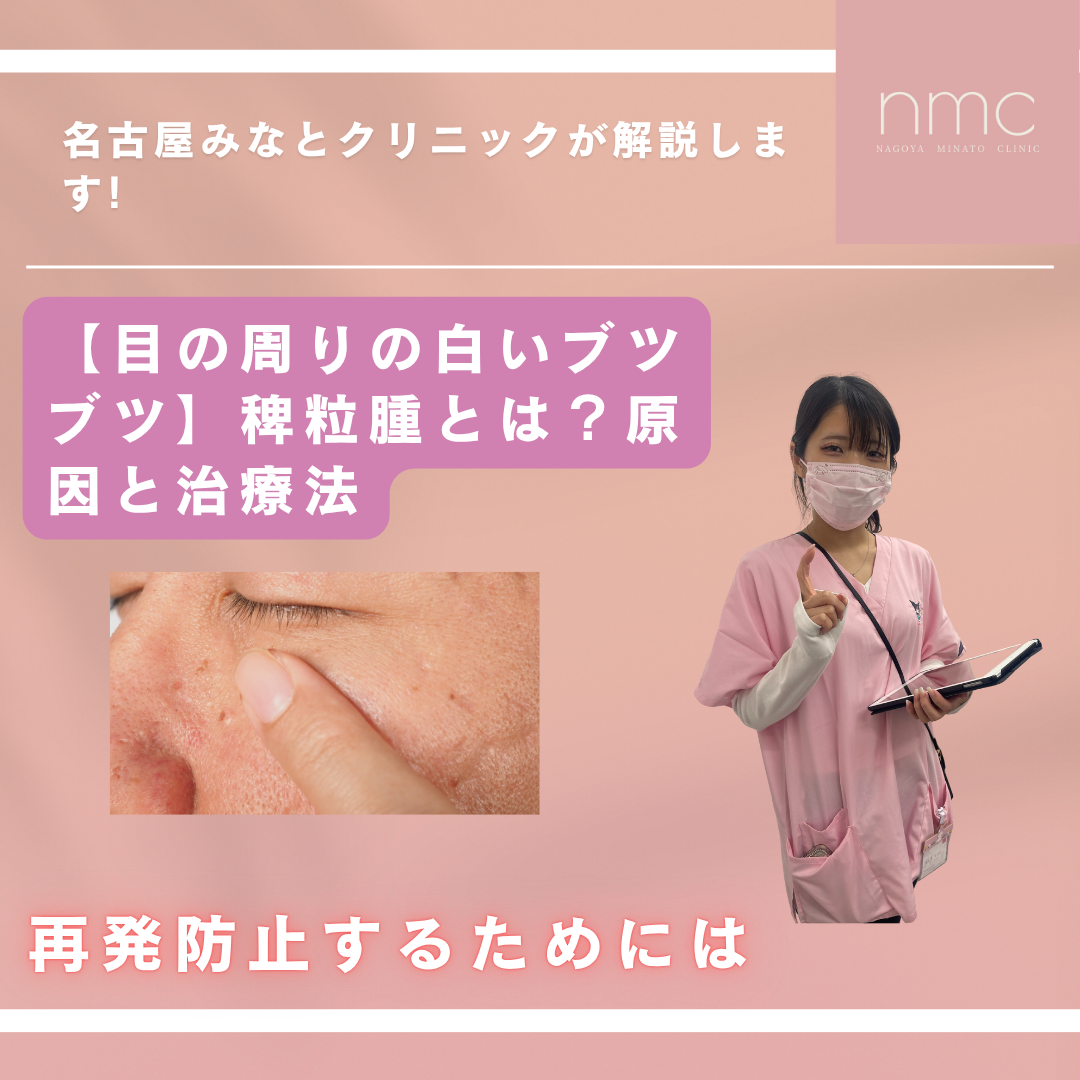 【目の周りの白いブツブツ】稗粒腫とは？原因と治療法について、名古屋市港区の皮膚科・美容皮膚科、名古屋みなとクリニックが解説