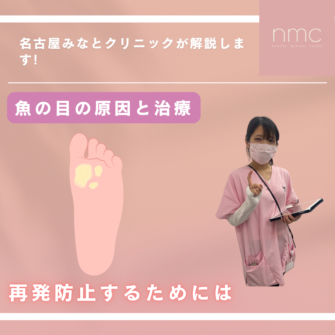 魚の目（鶏眼）の原因と治療について　名古屋市港区の皮膚科、美容皮膚科の名古屋みなとクリニックが解説