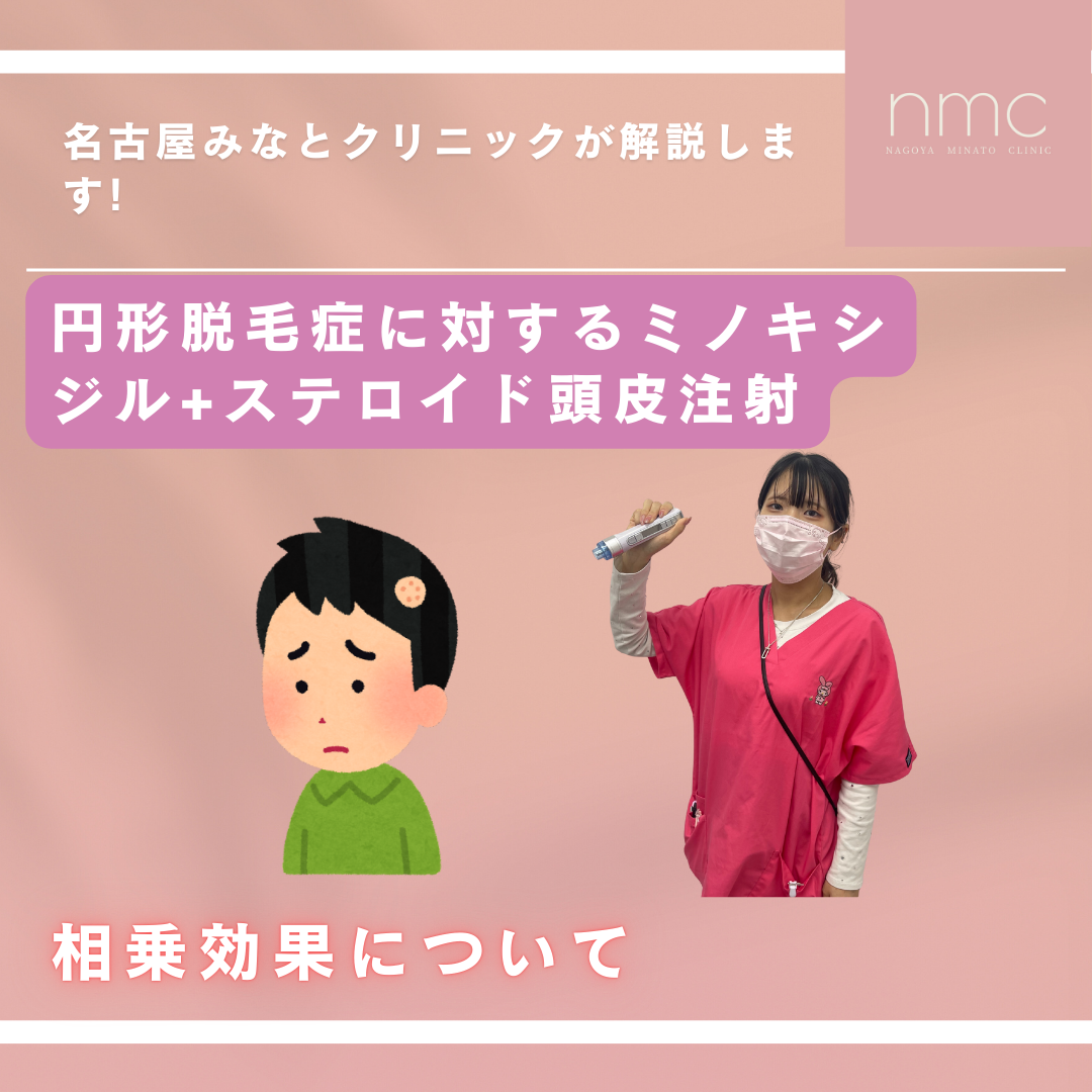円形脱毛症に対して「ミノキシジル＋ステロイド頭皮注射」の相乗効果とは？名古屋市港区、皮膚科・美容皮膚科、名古屋みなとクリニックが解説