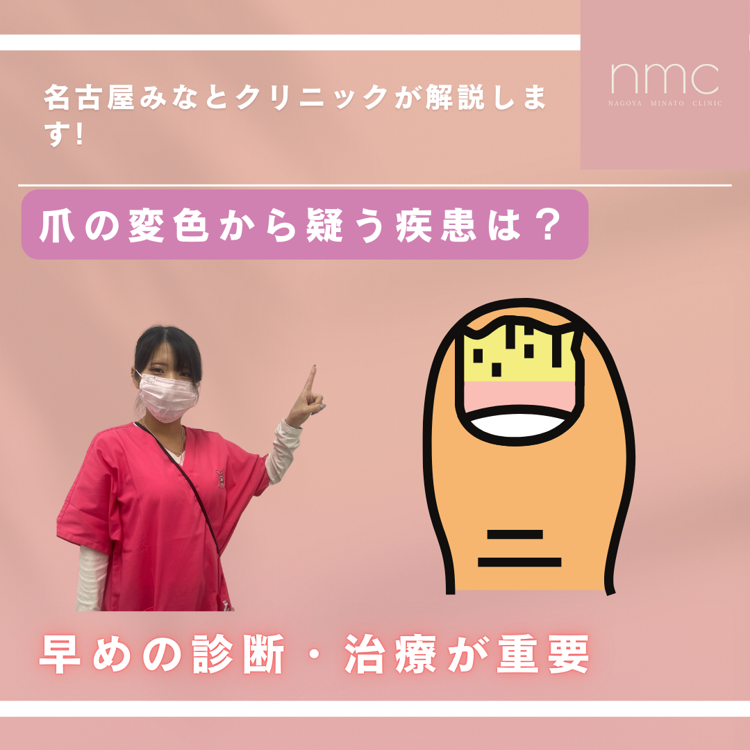 爪の変色からわかる病気とは？名古屋市港区、皮膚科・美容皮膚科、名古屋みなとクリニックが解説