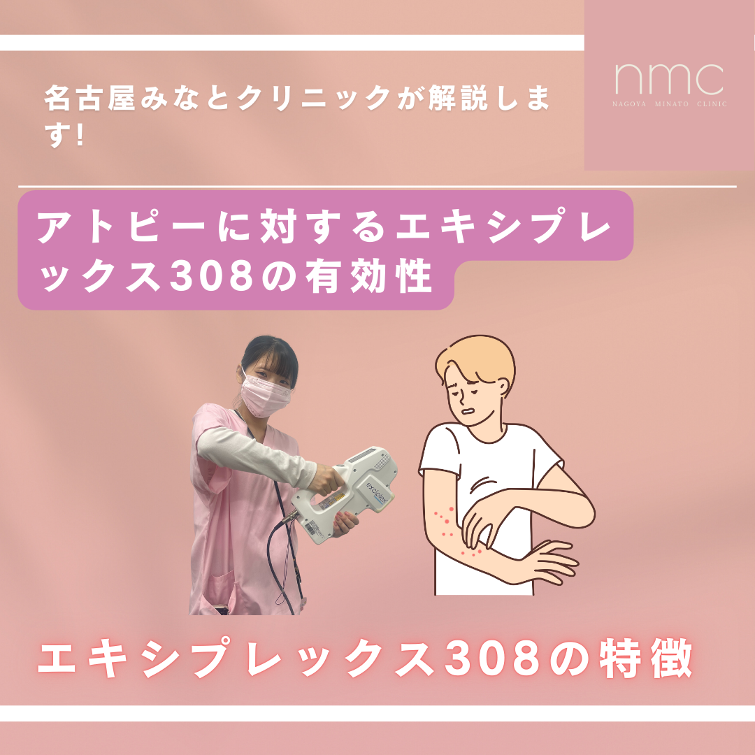 アトピー性皮膚炎に対するエキシプレックス308の有効性について　名古屋市港区、皮膚科・美容皮膚科、名古屋みなとクリニックが解説