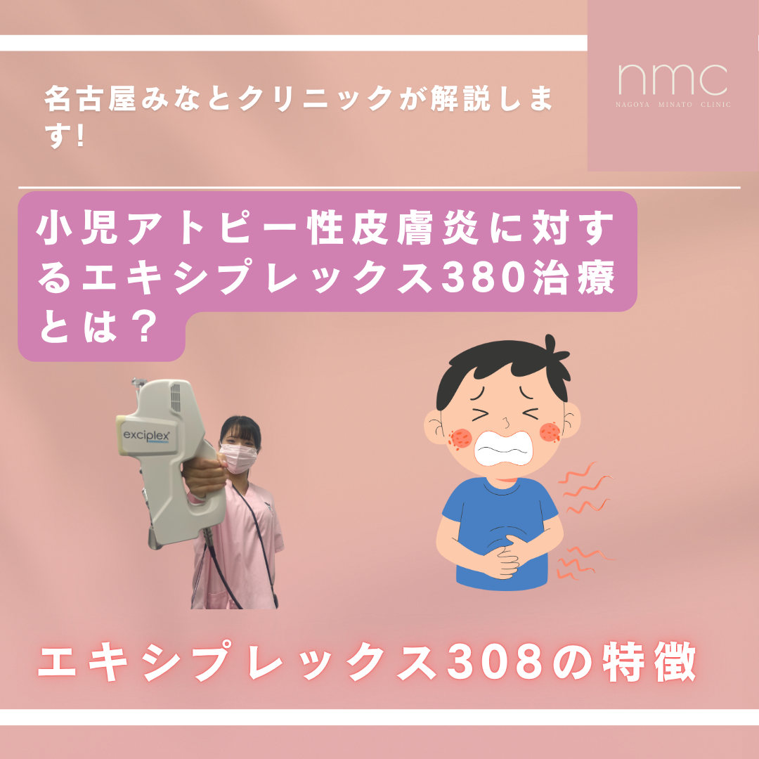 小児アトピー性皮膚炎に対するエキシプレックス380治療とは? 名古屋みなとクリニック(名古屋市港区)