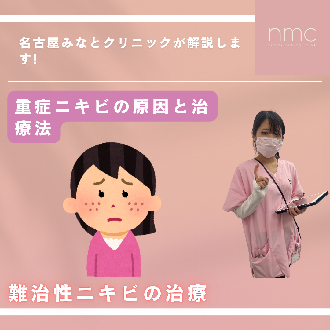 重症ニキビの原因と治療法 名古屋みなとクリニック（皮膚科・美容皮膚科）