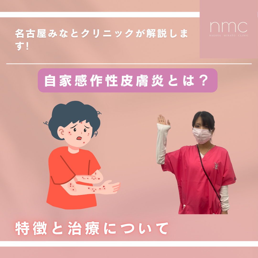 自家感作性皮膚炎とは？（名古屋市港区｜皮膚科・美容皮膚科 名古屋みなとクリニック）