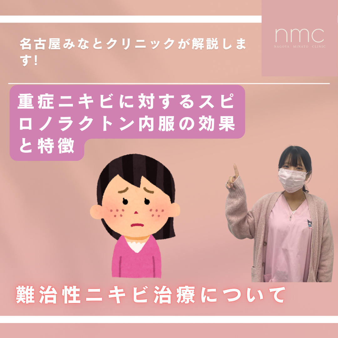 ✨重症ニキビでお悩みの女性へ「スピロノラクトンって本当に効くの？」を分かりやすく解説✨名古屋みなとクリニック