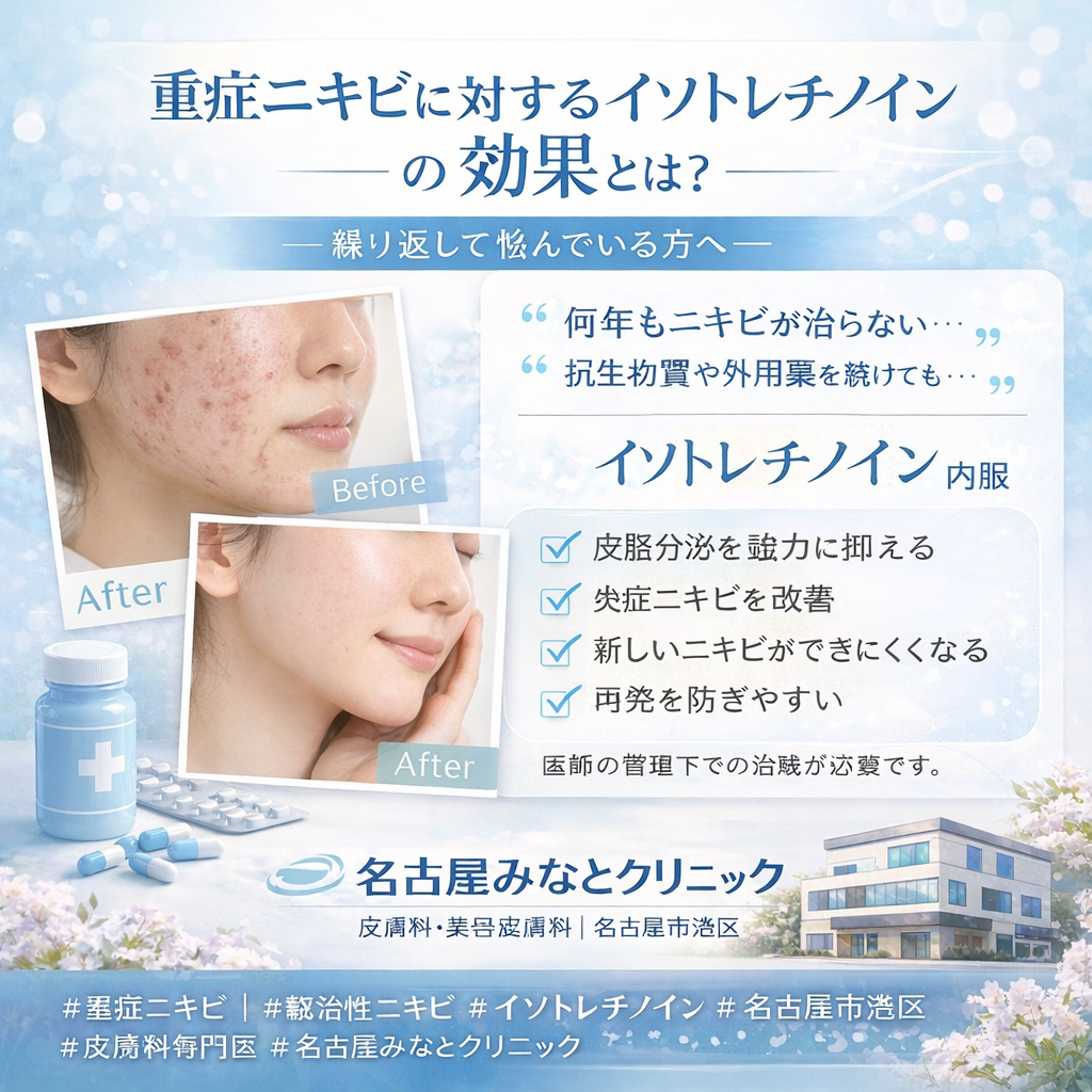 重症ニキビに対するイソトレチノインの効果とは？― 繰り返すニキビに悩む方へ ―　　名古屋みなとクリニック