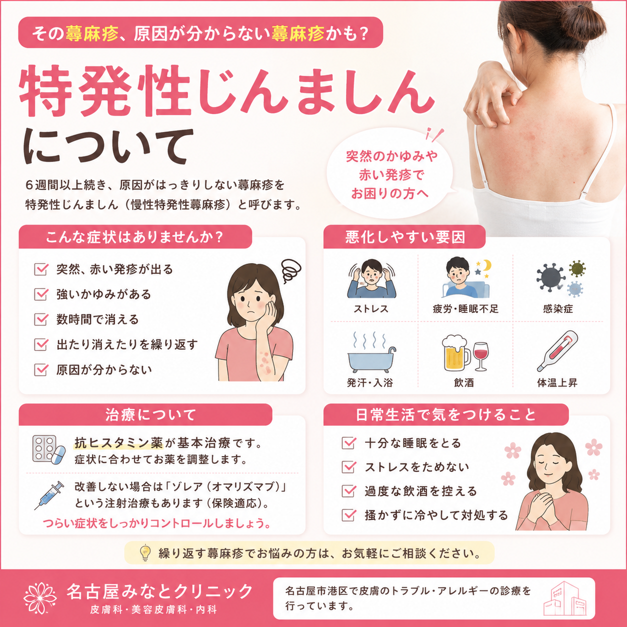 特発性じんましんとは？原因・診断・治療について皮膚科医が詳しく解説