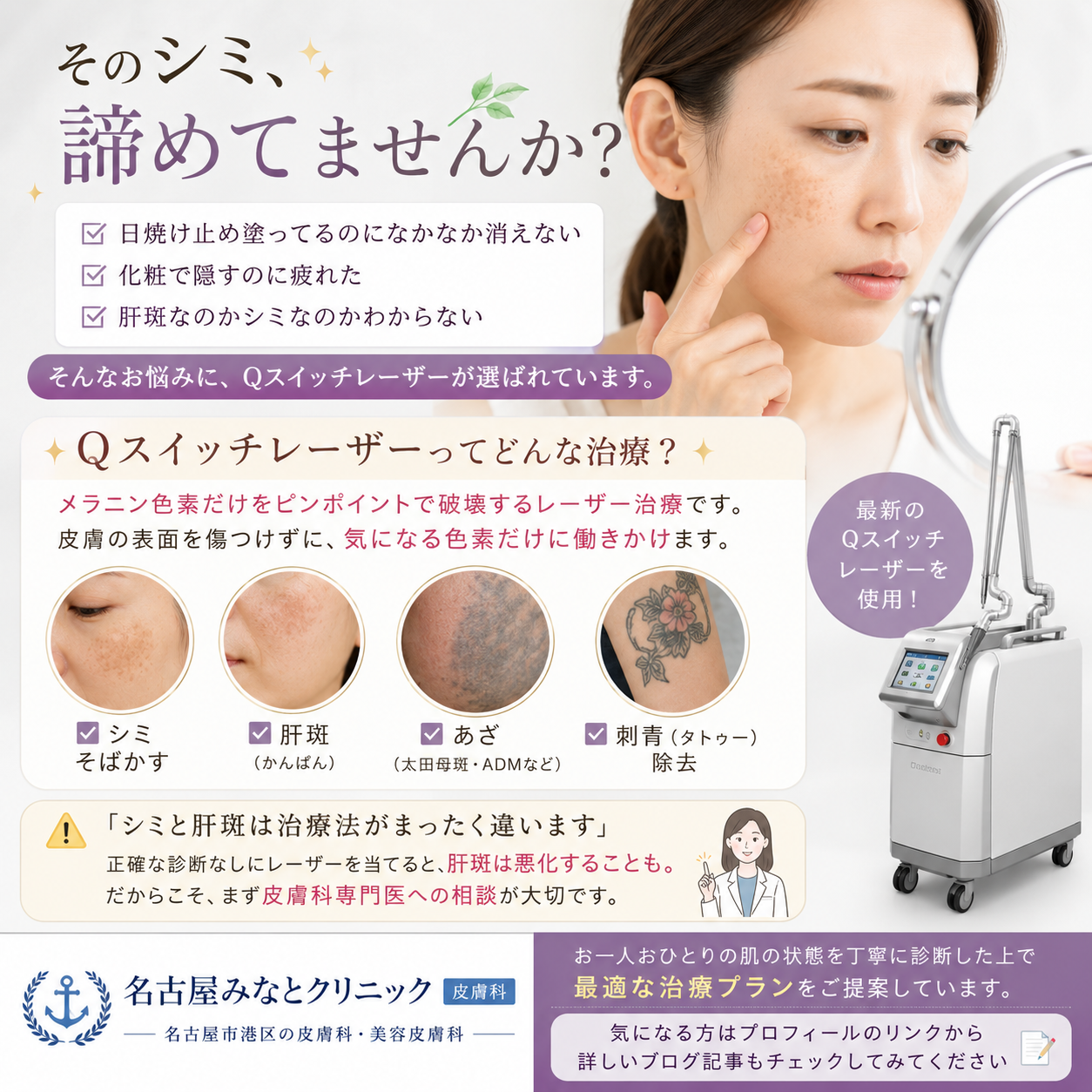 Qスイッチレーザーとは？シミ・肝斑・刺青に効果的な理由を名古屋