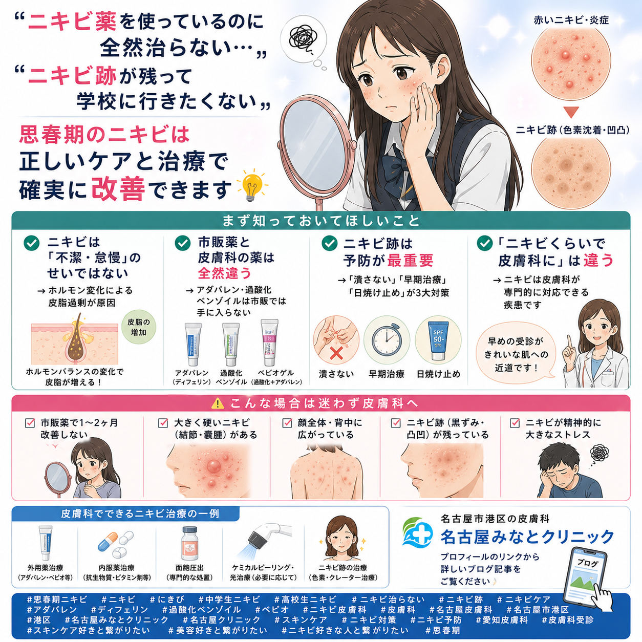 思春期のニキビ・ニキビ跡のケア——自宅でできること・クリニックで治療すべきことを名古屋みなとクリニック（名古屋市港区・皮膚科）が詳しく解説