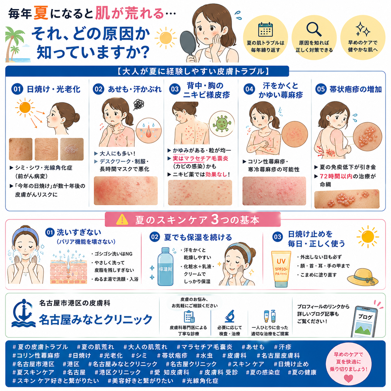 夏に出やすい皮膚症状——大人が気をつけたい肌トラブルと対策を名古屋みなとクリニック（名古屋市港区・皮膚科）が詳しく解説