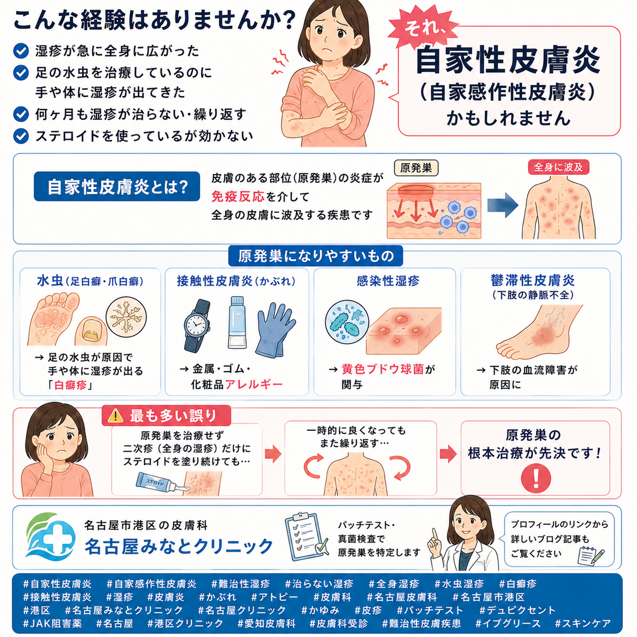 自家性皮膚炎（自家感作性皮膚炎）とは？難治性ケースの治療選択肢を名古屋みなとクリニック（名古屋市港区・皮膚科）が詳しく解説