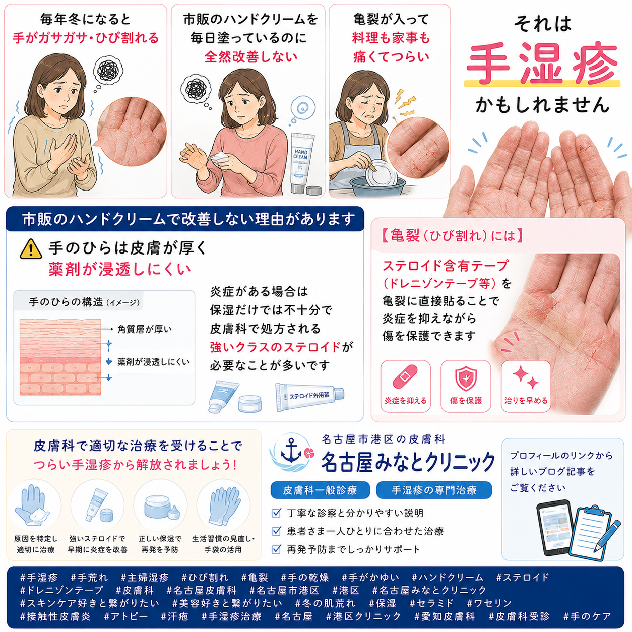 手湿疹・手荒れ——「市販のハンドクリームで追いつかない・亀裂が痛い」の原因と皮膚科での正しい治療を名古屋みなとクリニック（名古屋市港区・皮膚科）が詳しく解説