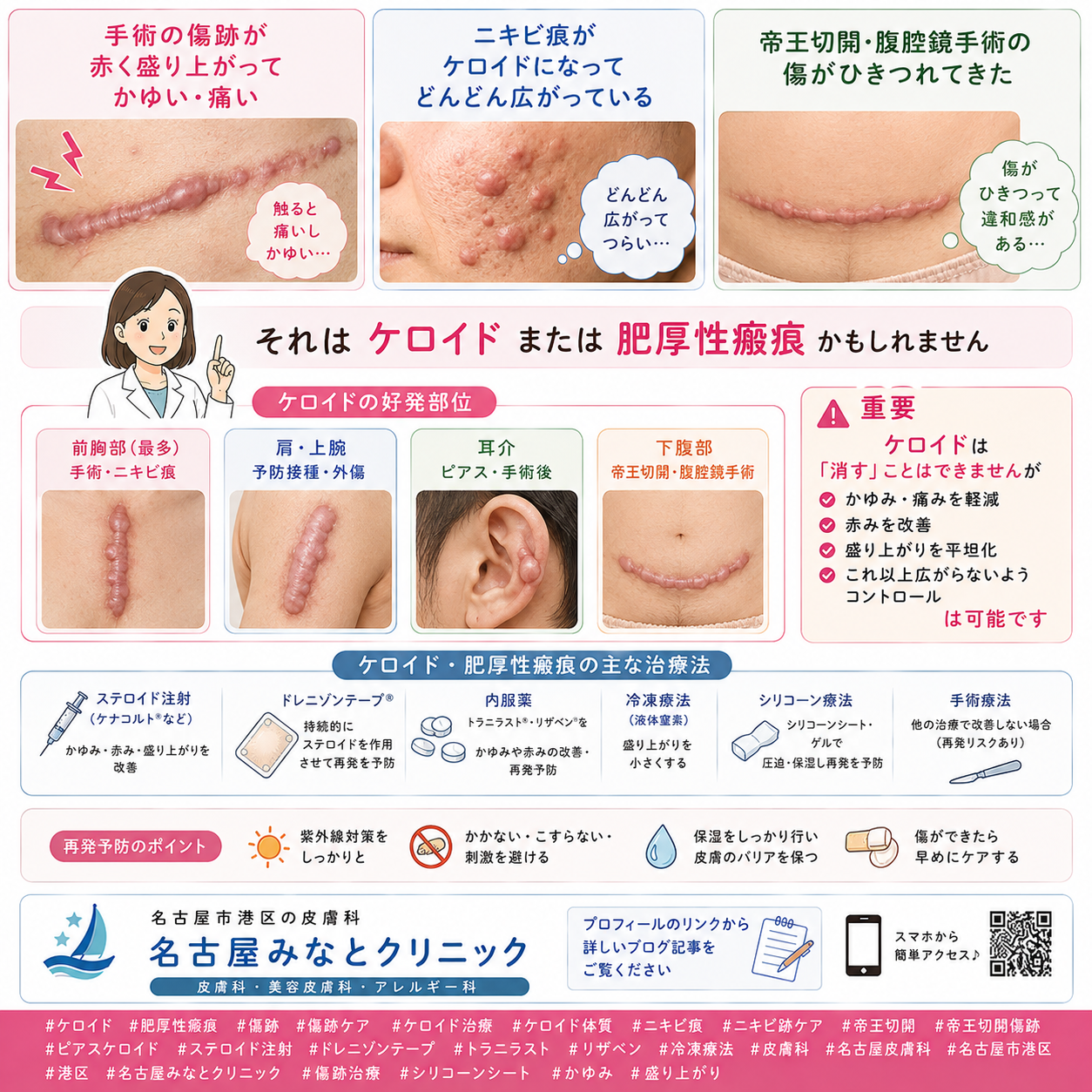 ケロイド・肥厚性瘢痕——傷跡が赤く盛り上がる・かゆい原因と治療（ステロイドテープ・注射・トラニラスト）を名古屋みなとクリニック（名古屋市港区・皮膚科）が詳しく解説