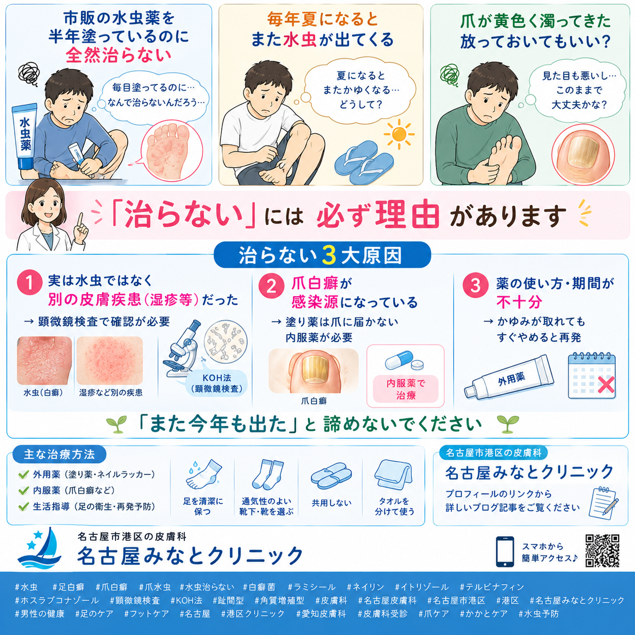 水虫（足白癬・爪白癬）——なかなか治らない水虫の正しい治療と爪水虫への内服薬を名古屋みなとクリニック（名古屋市港区・皮膚科）が詳しく解説