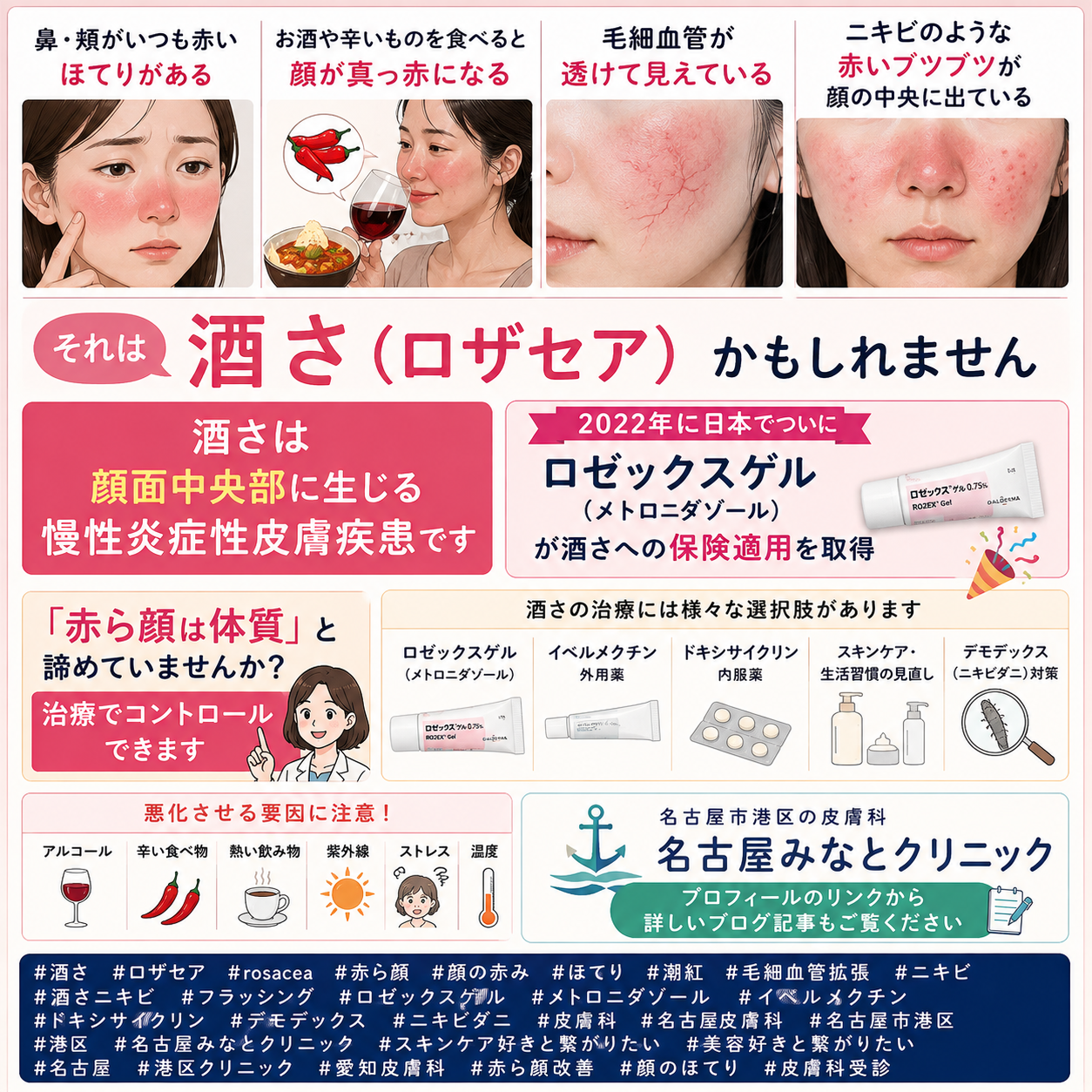 酒さ（ロザセア）——顔の赤み・ほてり・毛細血管拡張の原因と治療（ロゼックスゲル・ドキシサイクリン）を名古屋みなとクリニック（名古屋市港区・皮膚科）が詳しく解説