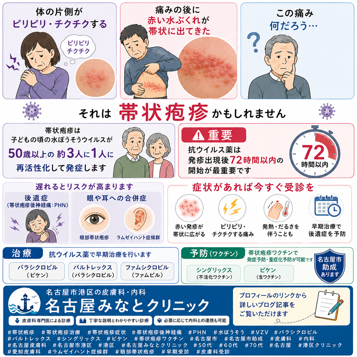 帯状疱疹——「ピリピリする・片側にみずぶくれが出た」の原因と治療・シングリックス・名古屋市ワクチン助成を名古屋みなとクリニック（名古屋市港区・皮膚科・内科）が詳しく解説
