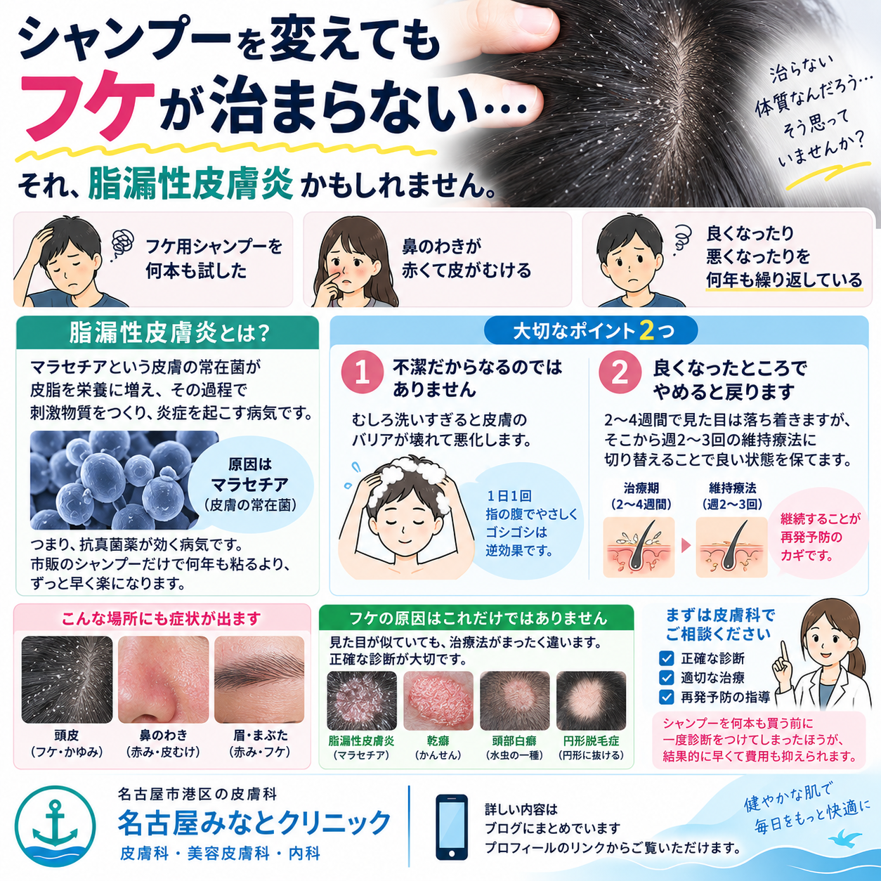 【名古屋市港区の皮膚科】フケが止まらない、鼻のわきが赤い…それは脂漏性皮膚炎かもしれません｜名古屋みなとクリニックが原因と治療を詳しく解説