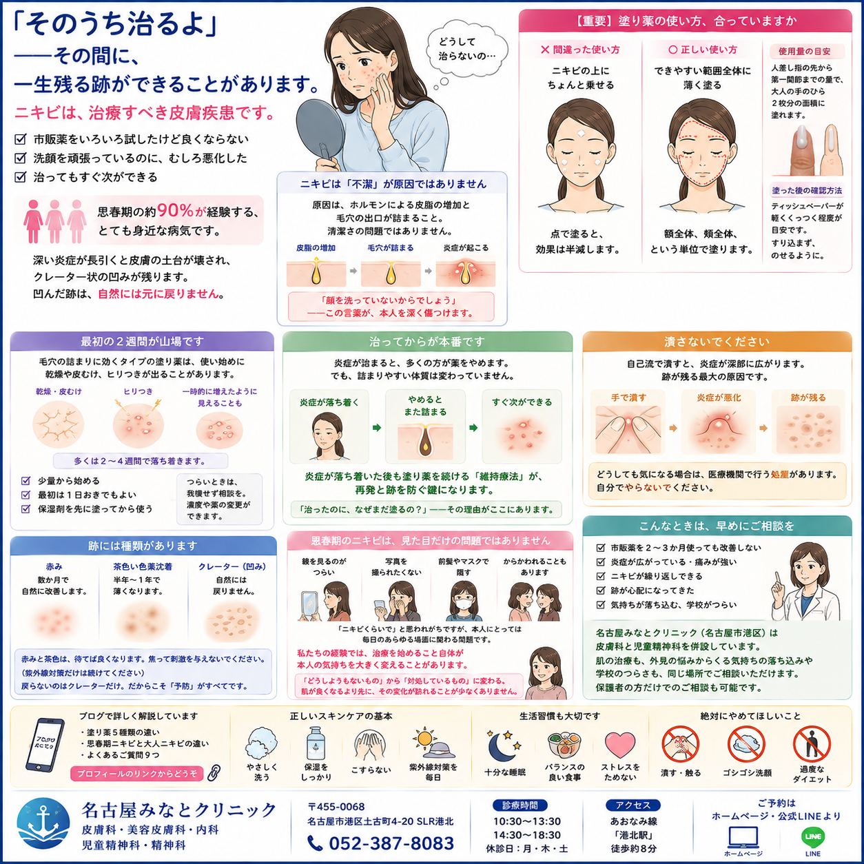 ニキビ（尋常性痤瘡）——「青春のシンボル」ではなく、跡が残る前に治すべき皮膚疾患です。種類・治療薬の違い・再発を防ぐ方法を名古屋みなとクリニック（名古屋市港区・皮膚科）が詳しく解説