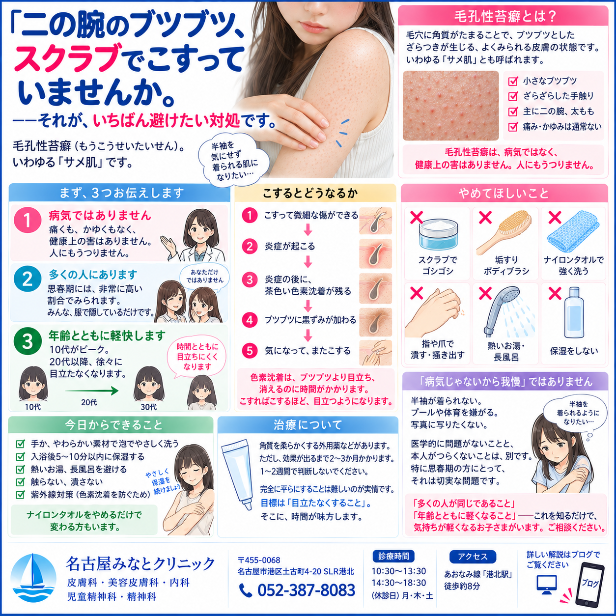 毛孔性苔癬（二の腕のブツブツ）——「サメ肌」は病気ではありません。こすってはいけない理由・目立たなくする方法を名古屋みなとクリニック（名古屋市港区・皮膚科／美容皮膚科）が詳しく解説