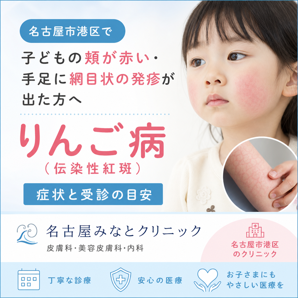 子どもの頬の赤みと手足にみられる網目状の発疹を説明する、りんご病（伝染性紅斑）のイメージ